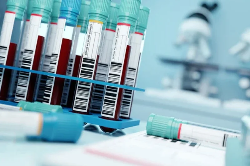 mvx blood test