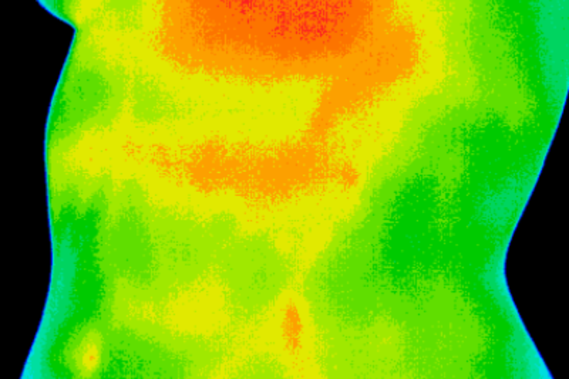 after-breast-thermography